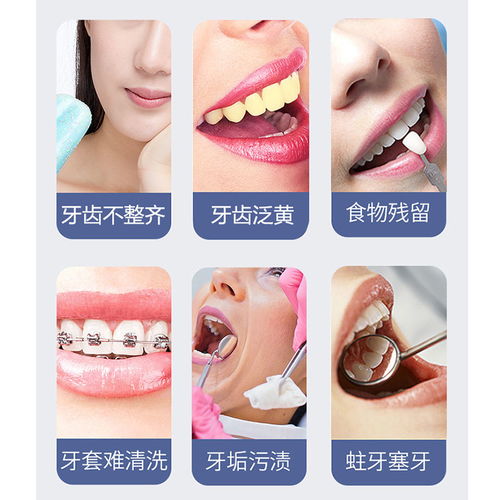 博皓便攜式智能洗牙器 開(kāi)啟高效、便捷的口腔清潔新體驗(yàn)